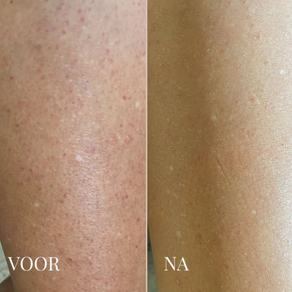 Dr. Melaxin Lichaamspeeling Spray