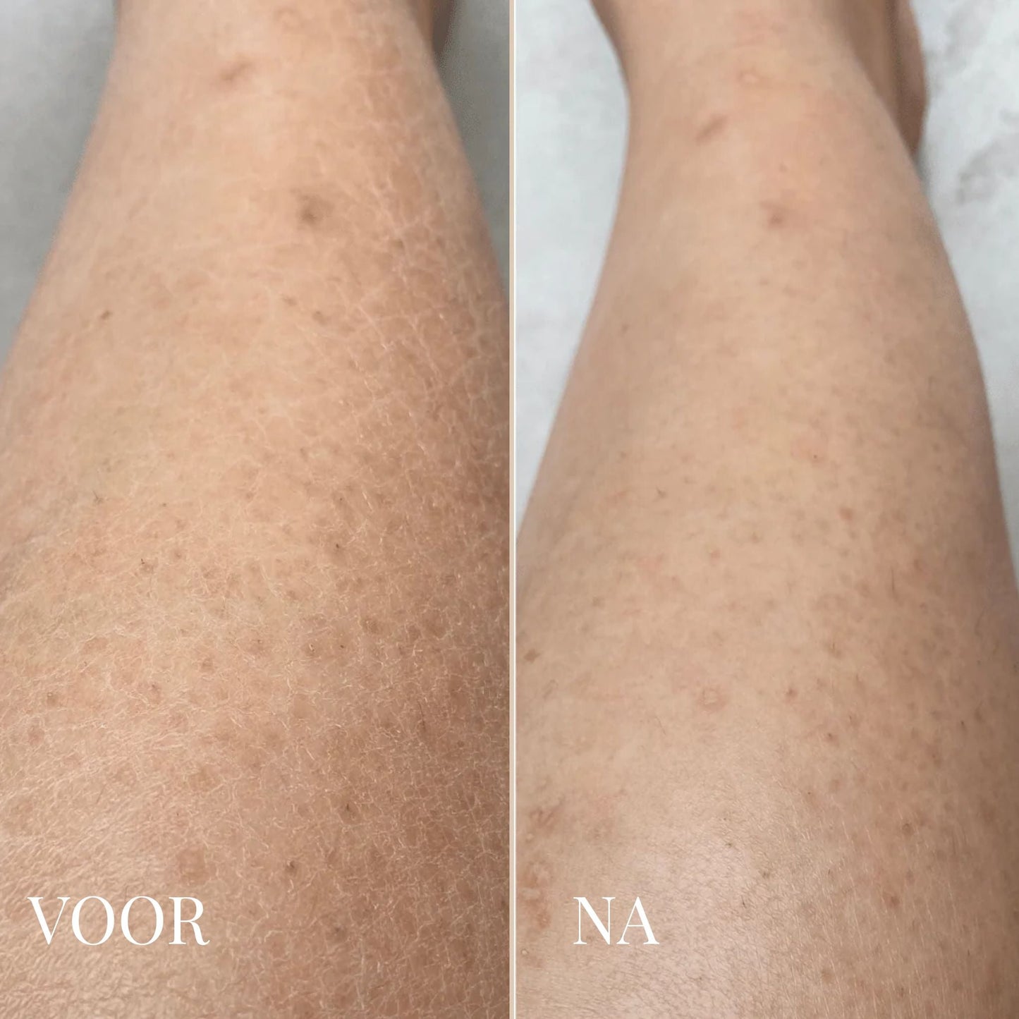 Dr. Melaxin Lichaamspeeling Spray