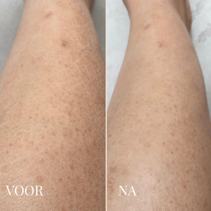 Dr. Melaxin Lichaamspeeling Spray