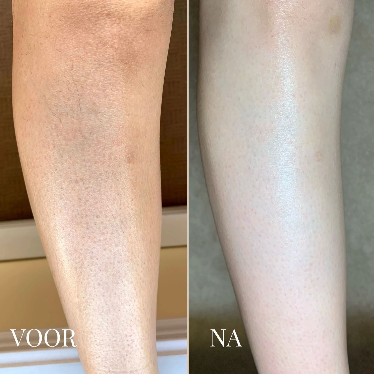 Dr. Melaxin Lichaamspeeling Spray