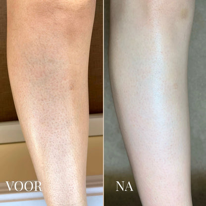 Dr. Melaxin Lichaamspeeling Spray